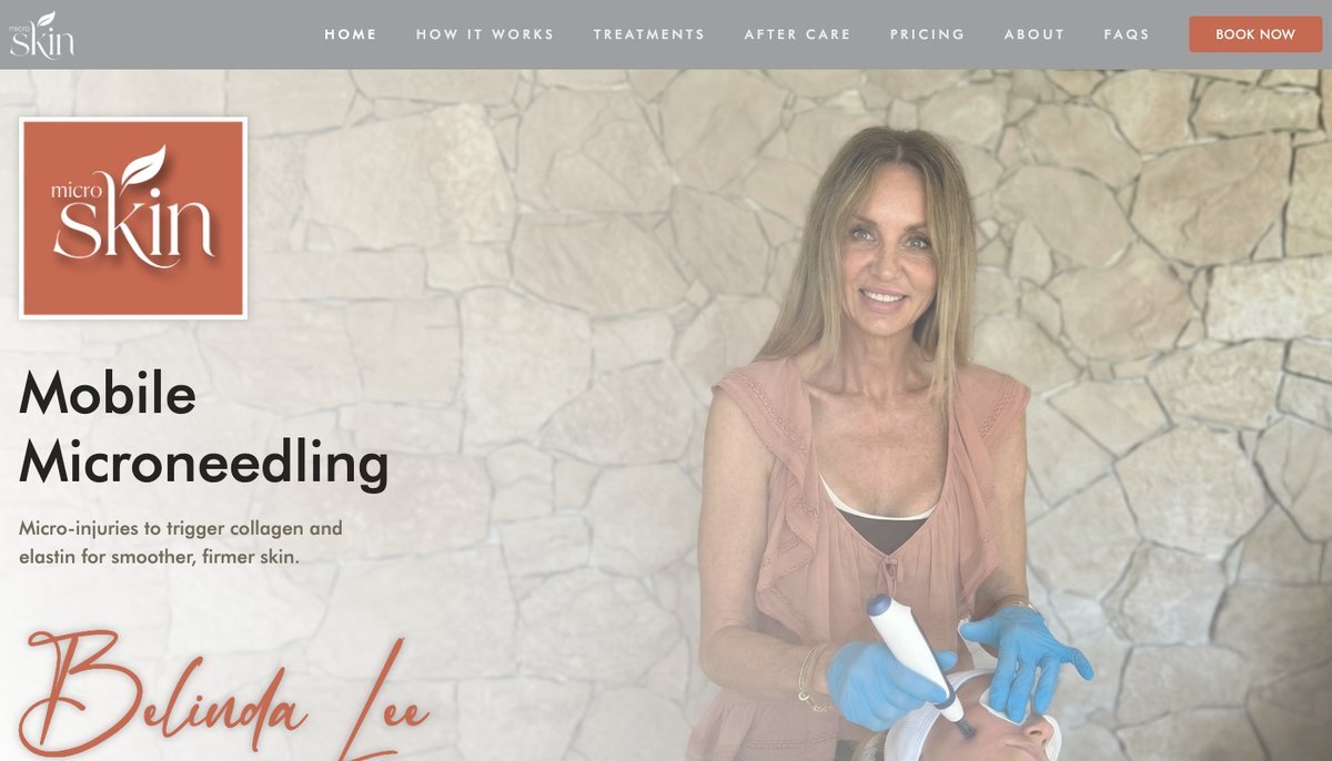 Micro Skin Newcastle homepage showing a microneedling treatment room with the headline Mobile Microneedling Newcastle and Lake Macquarie
